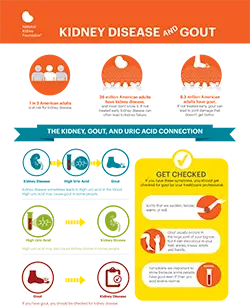 Infografis pengobatan asam urat